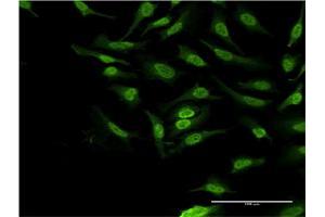 Immunofluorescence of monoclonal antibody to PBK on HeLa cell.