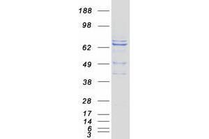 Validation with Western Blot