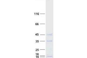 Western Blotting (WB) image for Mitochondrial rRNA Methyltransferase 1 Homolog (MRM1) protein (Myc-DYKDDDDK Tag) (ABIN2726325)