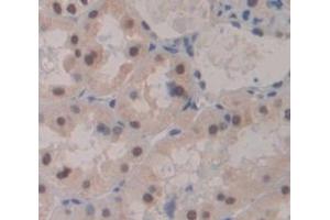 Used in DAB staining on fromalin fixed paraffin- embedded Kidney tissue (Mre11 Antikörper  (AA 375-609))