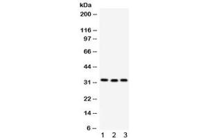 Western blot testing of 1) rat liver, 2) mouse spleen and 3) human MCF7 lysate with C1QBP antibody. (C1QBP Antikörper)