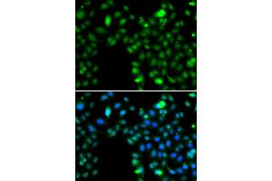 Immunofluorescence analysis of MCF-7 cells using ING5 antibody. (ING5 Antikörper)