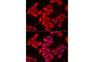 Immunofluorescence analysis of HeLa cells using SMPX antibody (ABIN6292730). (SMPX Antikörper)