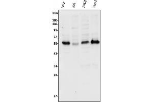 Western blot analysis of p57 Kip2/CDKN1C using anti-p57 Kip2/CDKN1C antibody (ABIN7602751).
