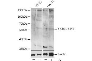 Western blot analysis of extracts of various cell lines, using Phospho-Chk1-S345 antibody (ABIN6135200, ABIN6136042, ABIN6136043 and ABIN6225600). (CHEK1 Antikörper  (pSer345))