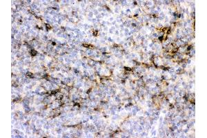 Alpha A Crystallin was detected in paraffin-embedded sections of rat spleen tissues using rabbit anti- Alpha A Crystallin Antigen Affinity purified polyclonal antibody (Catalog # ) at 1 ? (CRYAA Antikörper  (AA 1-173))