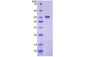 SDS-PAGE (SDS) image for Chitotriosidase (CHIT1) (AA 193-466) protein (His tag) (ABIN6237591)