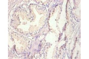Immunohistochemistry of paraffin-embedded human prostate tissue using ABIN7159509 at dilution of 1:100 (MT1A Antikörper  (AA 1-59))