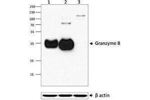Western Blotting (WB) image for anti-Granzyme B (GZMB) (AA 21-247) antibody (ABIN2666250) (GZMB Antikörper  (AA 21-247))