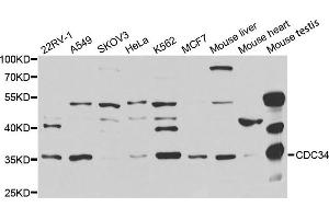 Western Blotting (WB) image for anti-Cell Division Cycle 34 (CDC34) antibody (ABIN1876645) (CDC34 Antikörper)