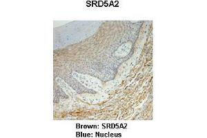 Sample Type :  Monkey vagina   Primary Antibody Dilution :   1:25   Secondary Antibody:  Anti-rabbit-HRP   Secondary Antibody Dilution:   1:1000   Color/Signal Descriptions:  Brown: SRD5A2 Blue: Nucleus   Gene Name:  SRD5A2   Submitted by:  Jonathan Bertin, Endoceutics Inc. (SRD5A2 Antikörper  (N-Term))