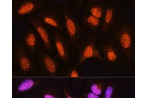 Immunofluorescence analysis of U2OS cells using HSPA2 Polyclonal Antibody at dilution of 1:100. (HSPA2 Antikörper)