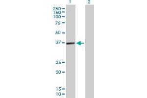 Western Blot analysis of PDLIM1 expression in transfected 293T cell line by PDLIM1 MaxPab polyclonal antibody. (PDLIM1 Antikörper  (AA 1-329))