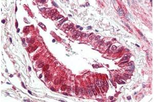 Human Lung, Respiratory Epithelium (formalin-fixed, paraffin-embedded) stained with BECN1 antibody ABIN461895 at 5 ug/ml followed by biotinylated goat anti-rabbit IgG secondary antibody ABIN481713, alkaline phosphatase-streptavidin and chromogen. (Beclin 1 Antikörper  (N-Term))