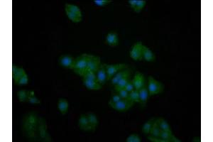 Immunofluorescence staining of HepG2 cells with ABIN7142697 at 1:200, counter-stained with DAPI. (PFKFB4 Antikörper  (AA 266-368))