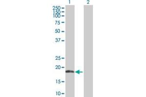 Western Blot analysis of ANK1 expression in transfected 293T cell line by ANK1 MaxPab polyclonal antibody. (Erythrocyte Ankyrin Antikörper  (AA 1-155))