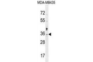 Western blot analysis in MDA-MB435 cell line lysates (35ug/lane) using Metaxin-2 Antibody (C-term).