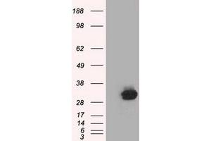 Western Blotting (WB) image for anti-Chromosome 21 Open Reading Frame 59 (C21orf59) antibody (ABIN1497042) (C21orf59 Antikörper)