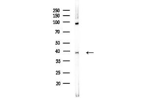 Western blot analysis of lysates from COLO205 cells(UV,30 min treatment), using RFC4 Antibody at 1/1000 dilution.