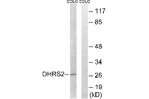 Western blot analysis of extracts from COLO cells, using DHRS2 antibody. (DHRS2 Antikörper)