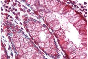 Human Colon (formalin-fixed, paraffin-embedded) stained with MUC2 antibody ABIN334258 at 5 ug/ml followed by biotinylated anti-mouse IgG secondary antibody ABIN481714, alkaline phosphatase-streptavidin and chromogen. (MUC2 Antikörper)