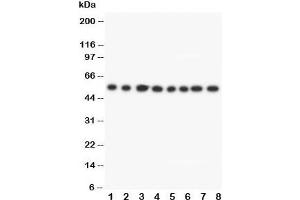 Western Blotting (WB) image for anti-Dihydrolipoamide Dehydrogenase (DLD) (C-Term) antibody (ABIN3030730)