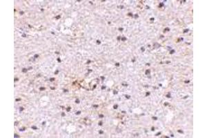 Immunohistochemistry of Ambra1 in human brain with Ambra1 antibody at 5 μg/ml. (AMBRA1 Antikörper  (N-Term))