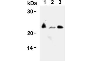 Western Blotting (WB) image for anti-CD3 (CD3) antibody (ABIN567797)