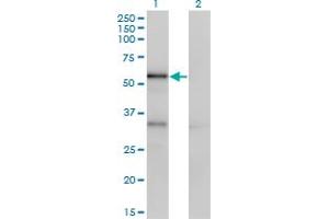 Western Blot analysis of SERPINA10 expression in transfected 293T cell line by SERPINA10 monoclonal antibody (M02), clone 1E11.