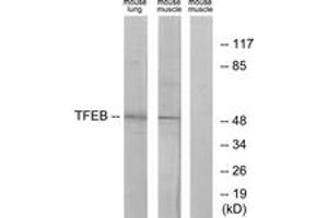 Western blot analysis of extracts from mouse lung/mouse muscle cells, using TFEB Antibody. (TFEB Antikörper  (AA 10-59))