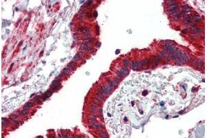 Anti-MMP14 antibody IHC of human lung, respiratory epithelium. (MMP14 Antikörper  (AA 160-173))