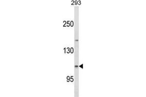 Western blot analysis of ESPN Antibody (N-term) in 293 cell line lysates (35ug/lane). (Espin Antikörper  (N-Term))