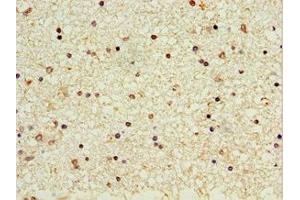 Immunohistochemistry of paraffin-embedded human brain tissue using ABIN7162964 at dilution of 1:100 (CROT Antikörper  (AA 1-87))