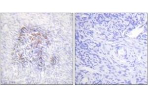 Immunohistochemistry analysis of paraffin-embedded human ovary, using IREB1 (Phospho-Ser138) Antibody. (Aconitase 1 Antikörper  (pSer138))