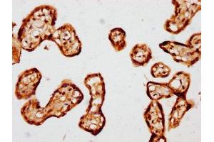 IHC image of ABIN7172758 diluted at 1:441 and staining in paraffin-embedded human placenta tissue performed on a Leica BondTM system. (TEAD1 Antikörper  (AA 135-215))