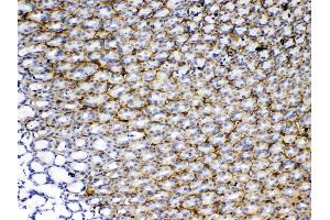 Immunohistochemistry (IHC) image for anti-Periostin (POSTN) (AA 577-810) antibody (ABIN5519054)