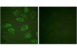 Immunofluorescence analysis of HeLa cells, using IL-2R alpha/CD25 (Phospho-Ser268) Antibody. (CD25 Antikörper  (pSer268))