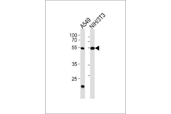 TBX4 Antikörper  (N-Term)