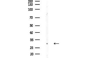 Western blot analysis of lysates from Rat brain, using IL15RA Antibody at 1/1000 dilution.