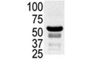 Western blot testing of ovary lysate with PAK2 antibody. (PAK2 Antikörper  (AA 192-222))