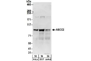 anti-Activating Signal Cointegrator 1 Complex Subunit 2 (ASCC2) (AA 500-550) antibody