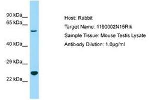 Image no. 1 for anti-Chromosome 3 Open Reading Frame 58 (C3ORF58) (AA 85-134) antibody (ABIN6749934) (C3orf58 Antikörper  (AA 85-134))
