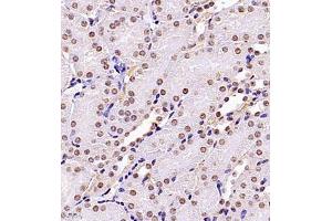 Immunohistochemistry of paraffin embedded mouse kidney using USP34 (ABIN7076115) at dilution of 1:700 (400x lens)