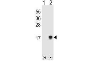 Western blot testing of SUMO2/3 antibody and 293T cell lysate either nontransfected (Lane 1) or transiently transfected (Lane 2) with the SUMO3 gene. (SUMO2/3 Antikörper  (AA 49-81))
