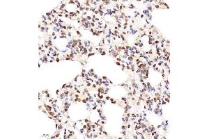 Immunohistochemistry of paraffin embedded rat lung using SHF-1 (ABIN7075710) at dilution of 1:600 (400x lens) (SHF Antikörper)