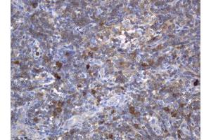 Image no. 1 for anti-Mast/stem Cell Growth Factor Receptor (KIT) (AA 546-976) antibody (ABIN1491585)