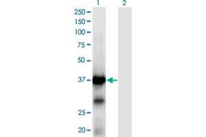 Western Blot analysis of XPA expression in transfected 293T cell line by XPA monoclonal antibody (M01), clone 2E4. (XPA Antikörper  (AA 1-273))