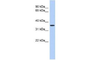 POLR3F antibody used at 1 ug/ml to detect target protein. (POLR3F Antikörper  (N-Term))