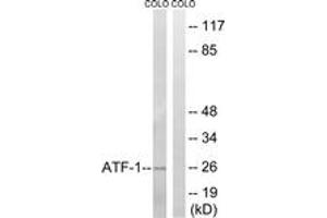 Western blot analysis of extracts from COLO cells, using ATF1 (Ab-63) Antibody.