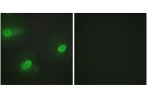 Immunofluorescence analysis of HeLa cells, using CSTF2 Antibody. (CSTF2 Antikörper  (AA 11-60))